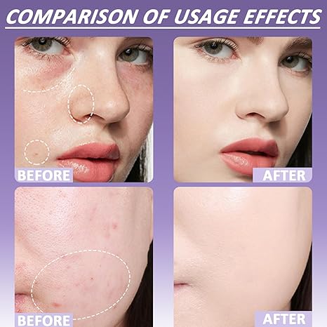🔥 SISTA DAGENS 49% AVSLAG🔥Soft Matte Cream Concealer